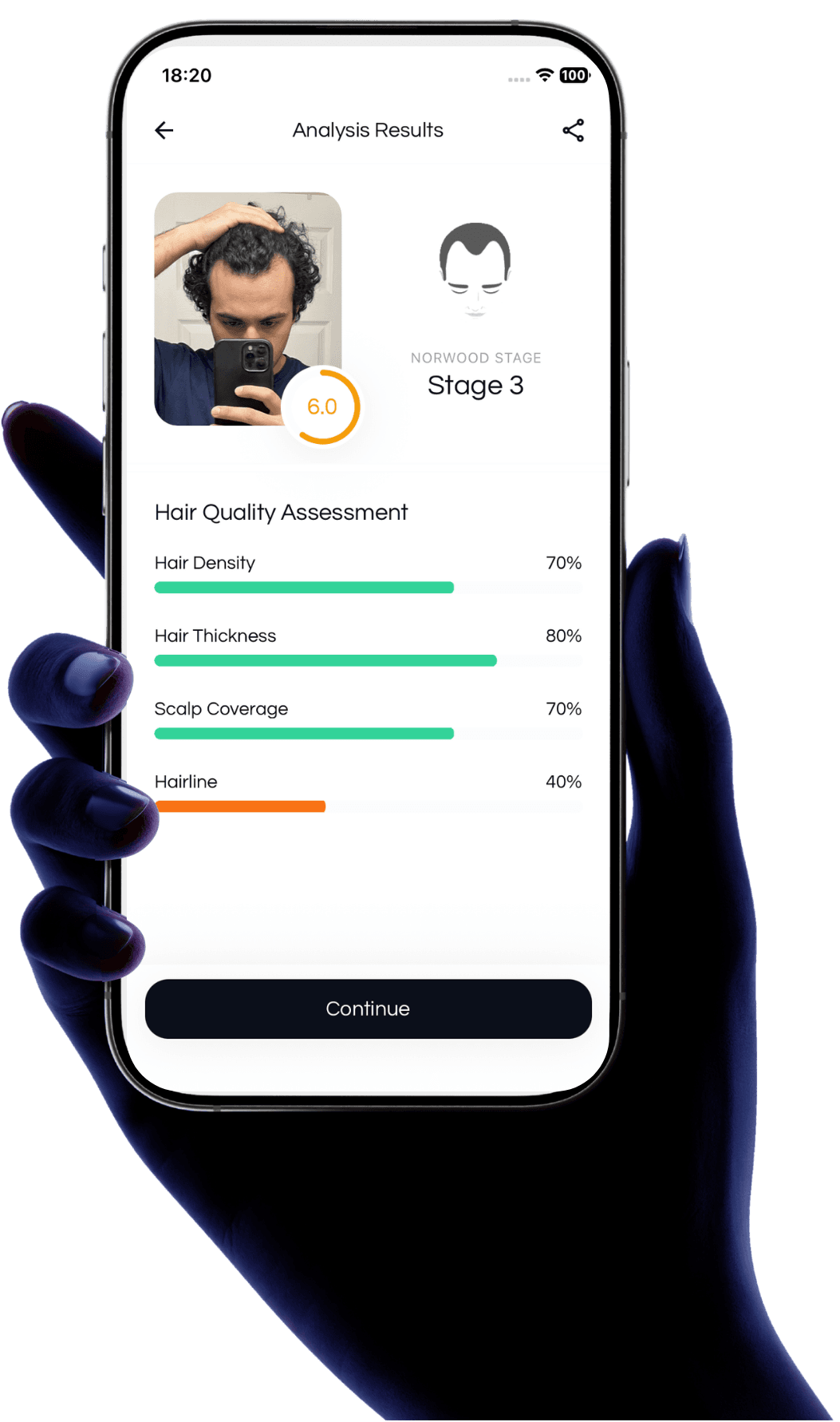 Balding AI app preview