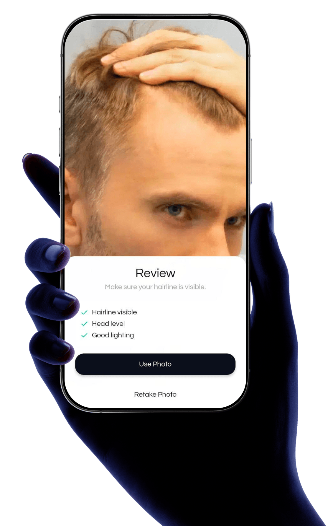 Balding AI app preview